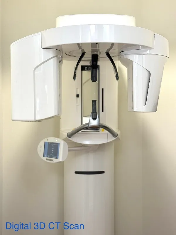 3D conebeam scanner technology