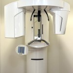 3D conebeam scanner technology