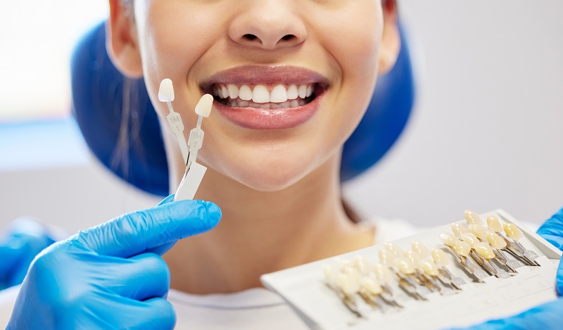 holding different tooth shades in preparation for teeth whitening