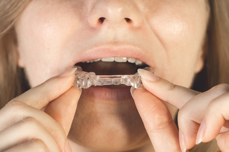 mouth guard for TMJ