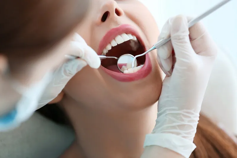 dental cleaning examinations